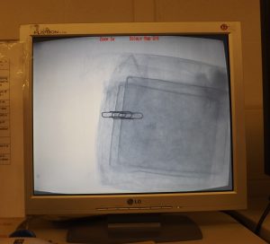 xray image